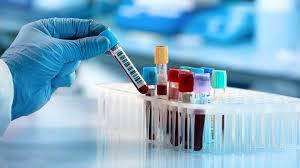 آزمایش خون و پاسخ به مهم ترین سوالات شما؛راهنمای تفسیر آزمایش خون
