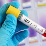 تغییر الگوی انتقال ایدز از تزریق مواد مخدر به روابط جنسی